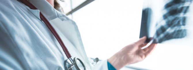 Аденогенный рак легкого