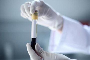 анализ крови лг