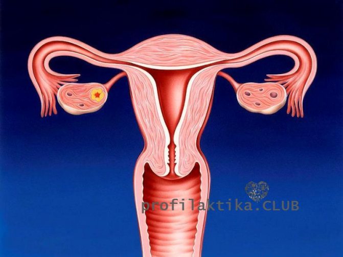 Цервикальный_стеноз