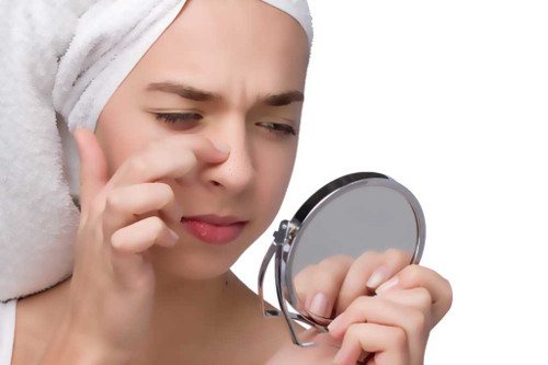 черные точки на носу