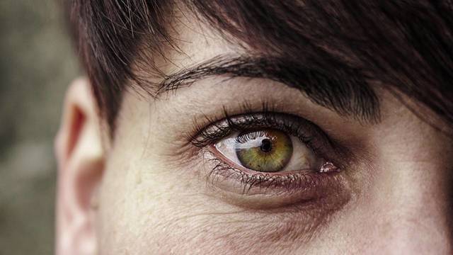 Чешутся глаза или веки – почему и что делать?