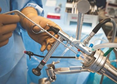 Проведение хирургического вмешательства двусторонним методом