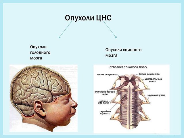 Схематический рисунок