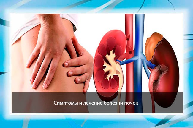 Симптомы и методы лечения заболеваний почек