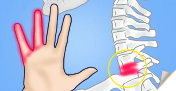 Симптомы онемения рук