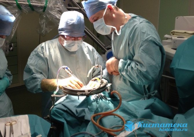 Существует несколько оперативных методик по устранению новообразования