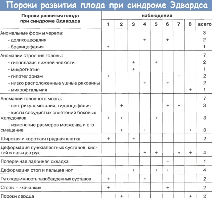 дети с синдромом эдвардса