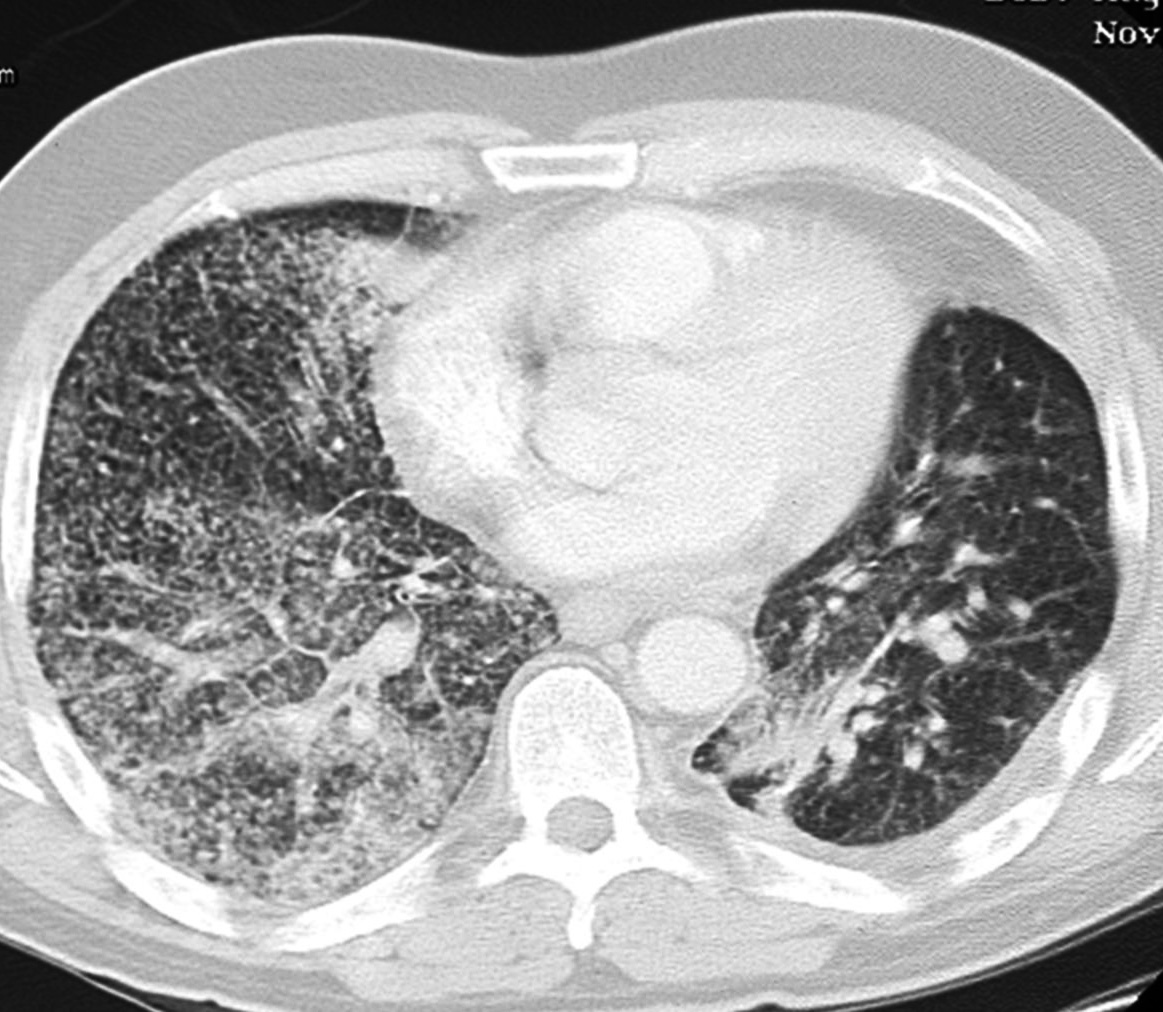 bac-ct-image